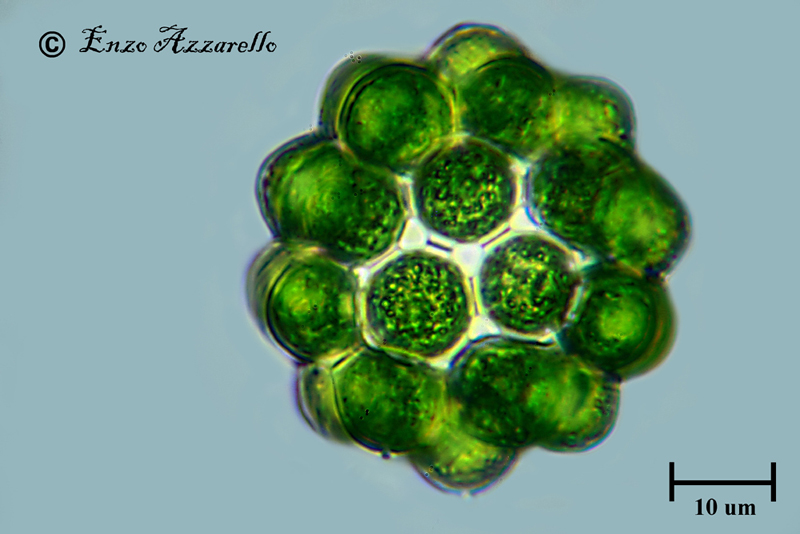 Coelastrum microporum 1000X